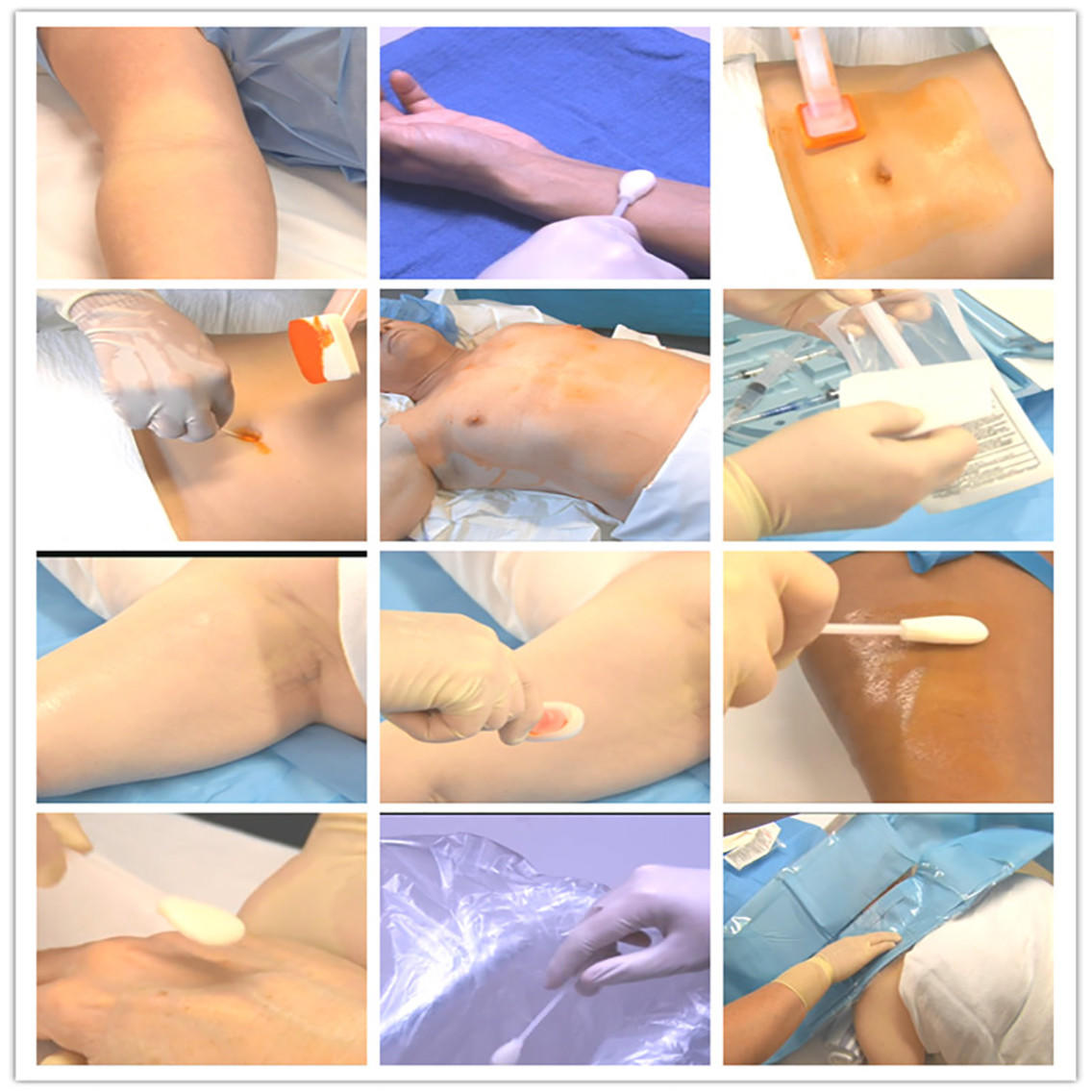 comfortable CHG applicators white ABS handle factory for surgical site cleansing after suturing